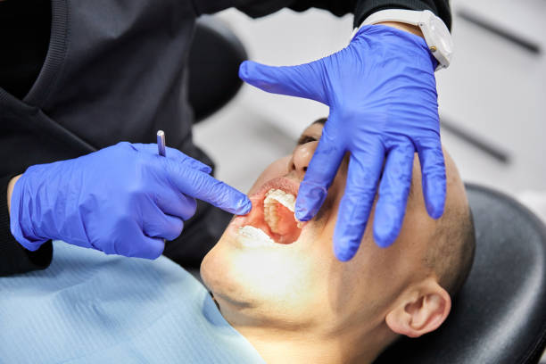Best Broken or Chipped Tooth Repair in Bellmore, NY